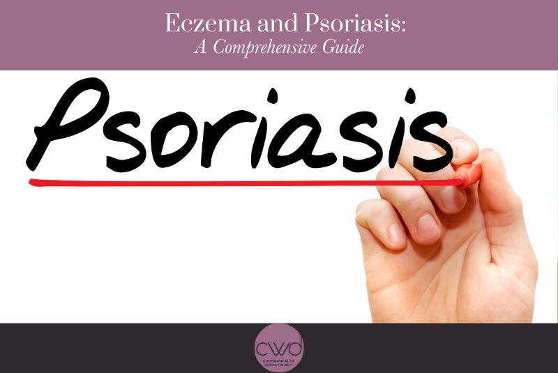 Eczema and Psoriasis AComprehensive Guide