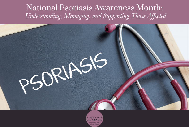 National Psoriasis Awareness MonthUnderstanding, Managing, and Supporting Those Affected