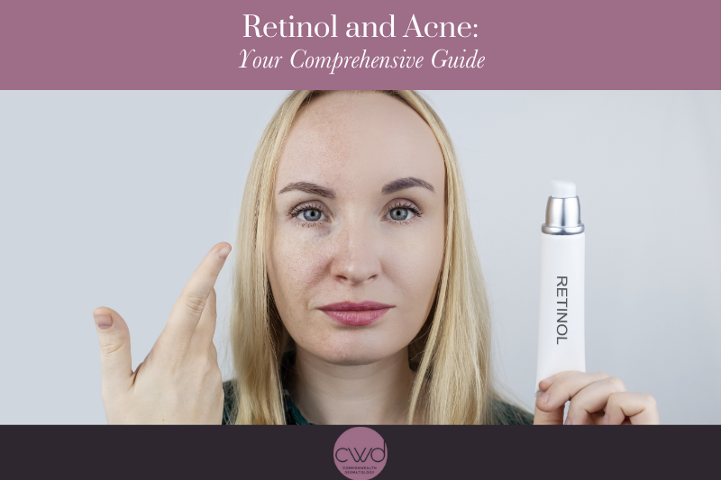 Retinol and AcneYour Comprehensive Guide